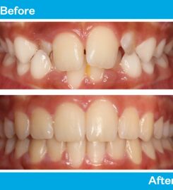 Solas orthodontics Perth