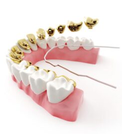 Solas orthodontics Perth
