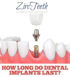 Zircteeth Of NH