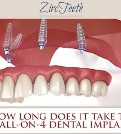 Zircteeth Of NH