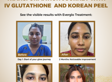 Best Skin Clinic Mogappair | Top Dermatologist in Mogappair