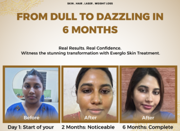 Best Skin Clinic Mogappair | Top Dermatologist in Mogappair