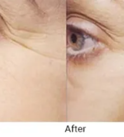Cosmetic Skin