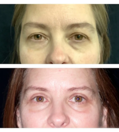Sandia Cosmetic Facial Surgery