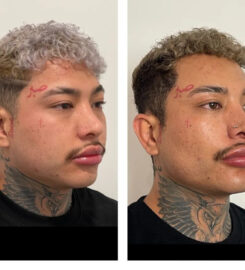Sandia Cosmetic Facial Surgery