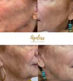Ageless Aesthetics & Wellness
