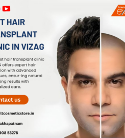 Hair Transplant Surgeon Vizag