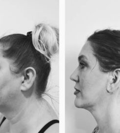 Sandia Cosmetic Facial Surgery