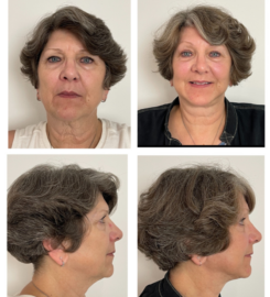 Sandia Cosmetic Facial Surgery