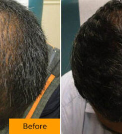 RAPAPORT HAIR INSTITUTE