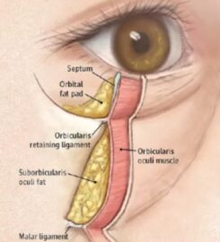 Argent Plastic Surgery