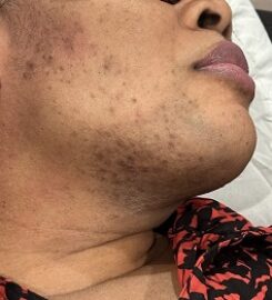 SkinPlus by Oroyo