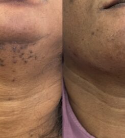 SkinPlus by Oroyo