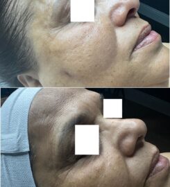SkinPlus by Oroyo