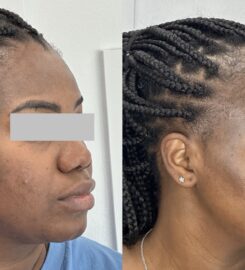 SkinPlus by Oroyo