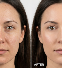 Enfield-Royal-Medspa