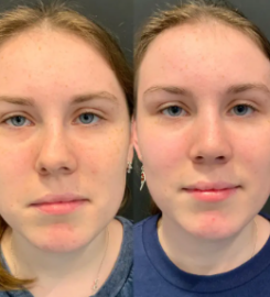 Real Plastic Surgery