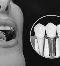 Egham Dental Care Implant and Cosmetic Centre