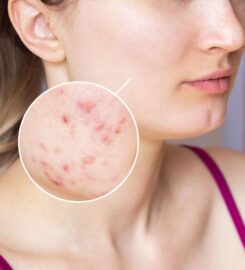 Derma Station The Skin Clinic – Dermatologist in Delhi