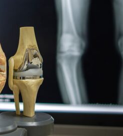 Dr. Anant Kumar Tiwari- Orthopaedic Surgeon Delhi