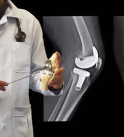 Dr. Anant Kumar Tiwari- Orthopaedic Surgeon Delhi