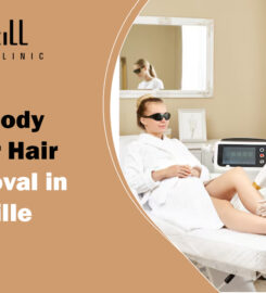 Morpheus8 Treatments in Oakville