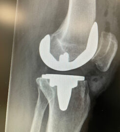 Leeds Knee Clinic