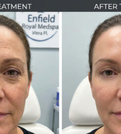 Enfield Royal Medspa Vier Fl |Brevard County