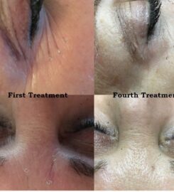 Complete Care Acupuncture and Wellness