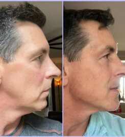 Randy Lindgren Aesthetic Rejuvenation