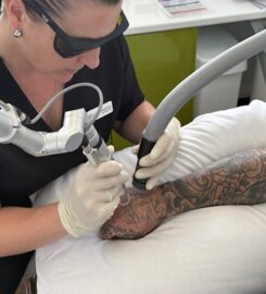 Best Tattoo Removal