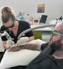 Best Tattoo Removal