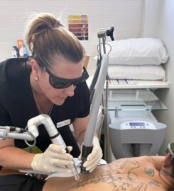 Best Tattoo Removal