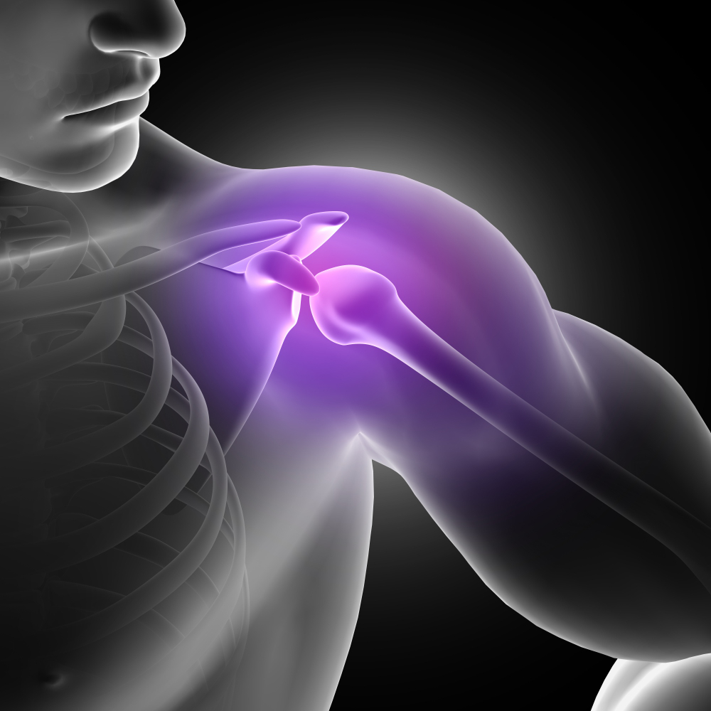 Non-Surgical Rotator Cuff Treatment: Restore Shoulder Strength Wi &hellip;