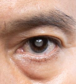 Asia Retina Eye Surgery Centre
