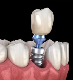 Richardson Family & Implant Dentistry