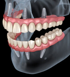 Richardson Family & Implant Dentistry