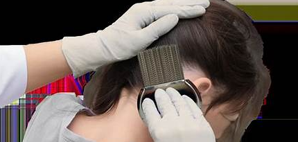 Larger Than Lice | Lice Treatment & Nit Removal Service in Ne &hellip;