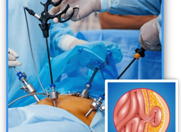 Dr. Lalatendu Mahapatra – Gastrointestinal Surgeon in Bhuba …