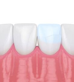 Smith Dental Care