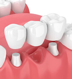Smith Dental Care