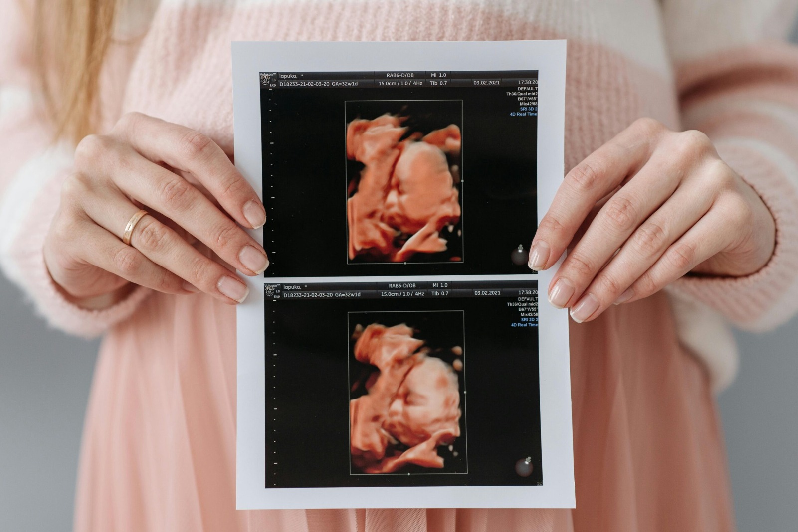 3D 4D 5D Baby Ultrasound Studio