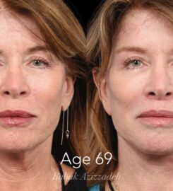 Center For Advanced Facial Plastic Surgery
