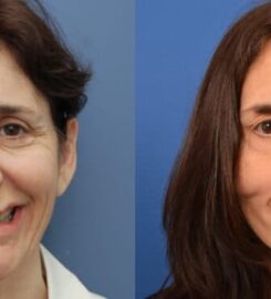 Center For Advanced Facial Plastic Surgery