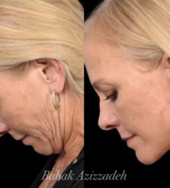 Center For Advanced Facial Plastic Surgery