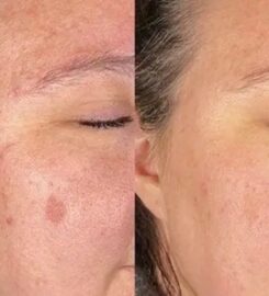 La Beauty Boutique | Medical Spa & Skincare Clinic