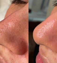 La Beauty Boutique | Medical Spa & Skincare Clinic
