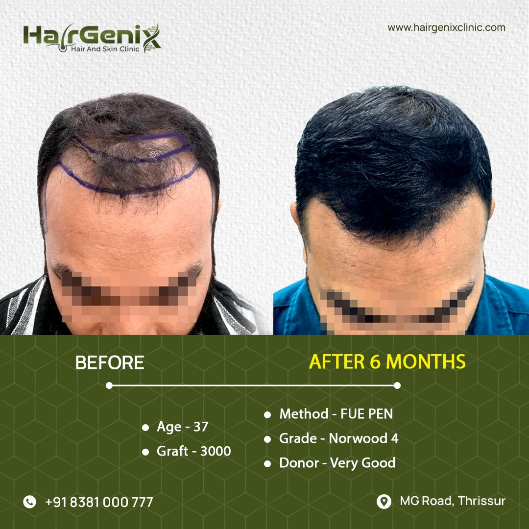 Hairgenix hair and skin clinic