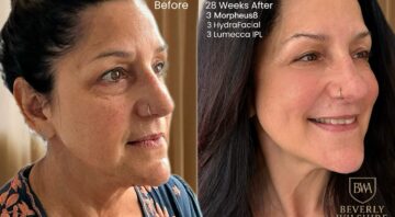 Beverly Wilshire Aesthetics Beverly Hills Medical Spa