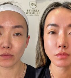 Beverly Wilshire Aesthetics Beverly Hills Medical Spa